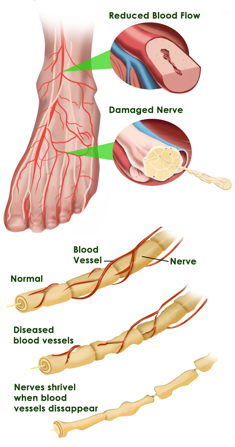 Leading Physical Therapy Specialist: The Best Method To Relieve Neurop